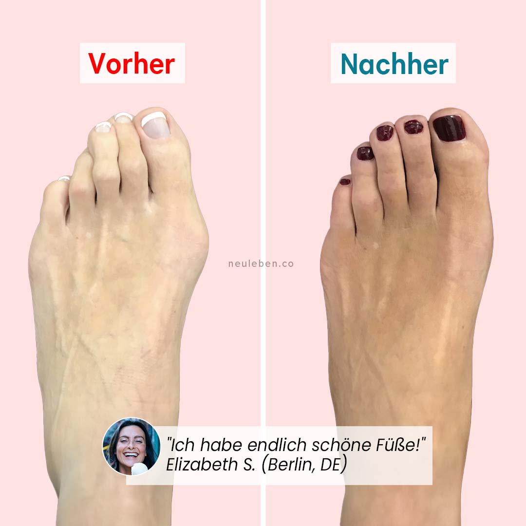 PerfectToes - Natürlicher Zehentrenner